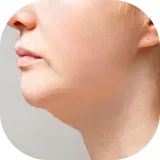 Papada